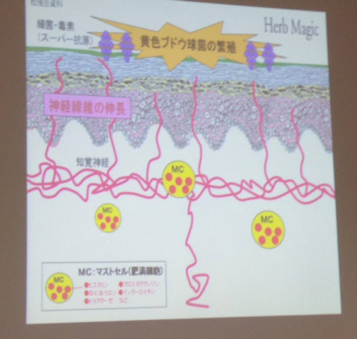 山口県山陽小野田市厚狭の美容院・美容室・カット　美容室びーだま お知らせ・ニュース　頭皮洗浄・頭皮デトックス